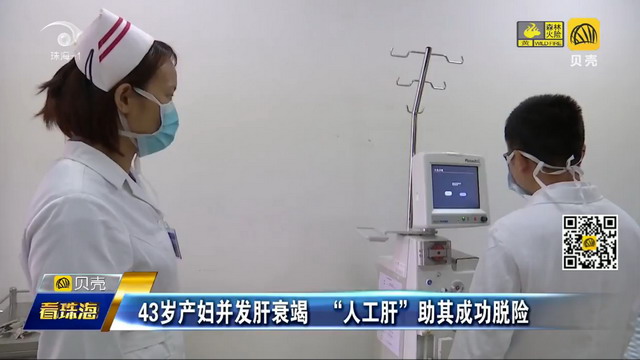 中山大学附属第五医院“人工肝”技术救回肝衰竭产妇