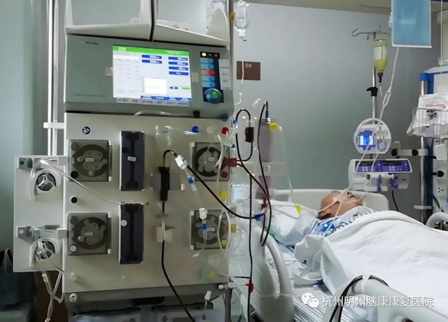 杭州明州脑康康复医院实施首例CRRT新技术救治获成功